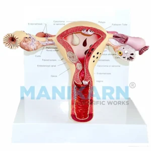 FEMALE UTERUS DUMMY